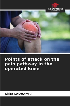 Paperback Points of attack on the pain pathway in the operated knee Book