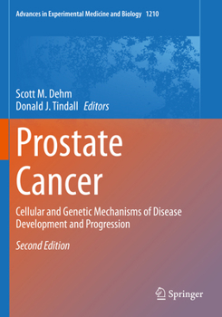 Paperback Prostate Cancer: Cellular and Genetic Mechanisms of Disease Development and Progression Book
