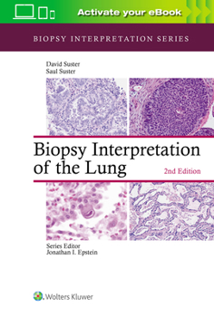 Hardcover Biopsy Interpretation of the Lung Book