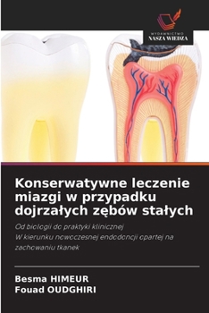 Konserwatywne leczenie miazgi w przypadku dojrzalych zebów stalych (Polish Edition)