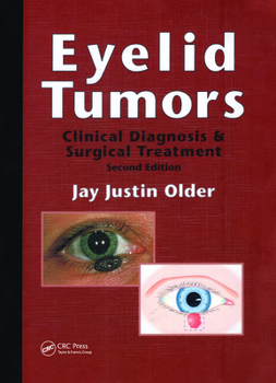 Hardcover Eyelid Tumors Book