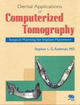 Hardcover Dental Applications of Computerized Tomography: Surgical Planning for Implant Placement Book