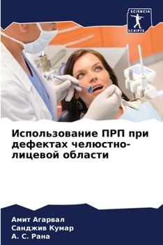Paperback Использование ПРП при де [Russian] Book