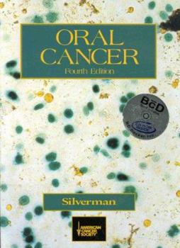 Paperback American Cancer Society Atlas of Clinical Oncology: Oral Cancer (Book with CD-ROM) [With *] Book