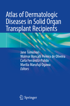 Paperback Atlas of Dermatologic Diseases in Solid Organ Transplant Recipients Book