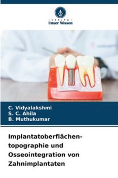 Implantatoberflächen- topographie und Osseointegration von Zahnimplantaten (German Edition)