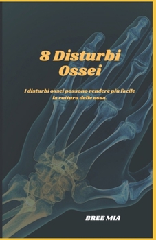 8 Disturbi Ossei: I disturbi ossei possono rendere più facile la rottura delle ossa. (Italian Edition)