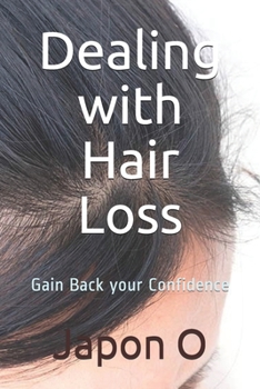 Paperback Dealing with Hair Loss: Gain Back your Confidence Book
