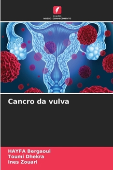 Paperback Cancro da vulva [Portuguese] Book