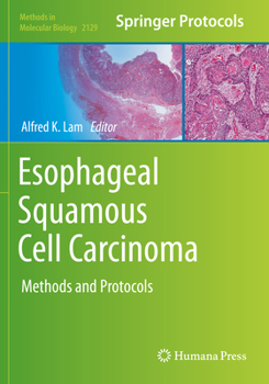Paperback Esophageal Squamous Cell Carcinoma: Methods and Protocols Book