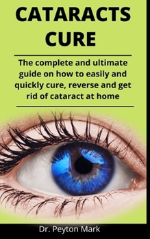 Paperback Cataracts Cure: The Complete And Ultimate Guide On How To Easily And Quickly Cure, Reverse And Get Rid Of Cataract At Home Book