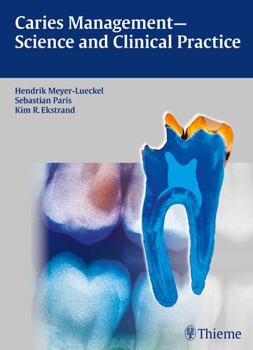 Hardcover Caries Management - Science and Clinical Practice Book