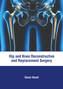 Hardcover Hip and Knee Reconstructive and Replacement Surgery Book