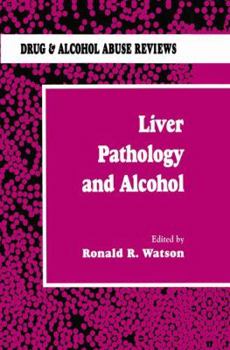Hardcover Liver Pathology and Alcohol: Drug & Alcohol Abuse Reviews Book