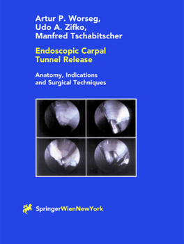 Hardcover Endoscopic Carpal Tunnel Release Book