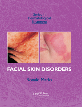 Paperback Facial Skin Disorders Book