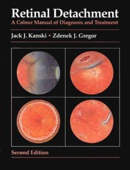 Hardcover Retinal Detachment: A Colour Manual of Diagnosis and Treatment (Colour Manuals in Ophthalmology) Book