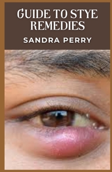 Guide to Stye Remedies: A stye is a lump on the eyelid caused by a bacterial infection.