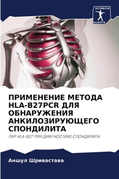 Paperback &#1055;&#1056;&#1048;&#1052;&#1045;&#1053;&#1045;&#1053;&#1048;&#1045; &#1052;&#1045;&#1058;&#1054;&#1044;&#1040; HLA-B27PCR &#1044;&#1051;&#1071; &#1 [Russian] Book