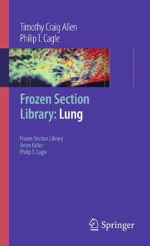 Paperback Frozen Section Library: Lung Book