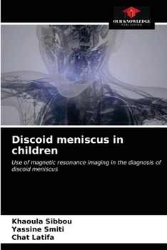 Paperback Discoid meniscus in children Book