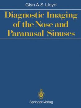 Paperback Diagnostic Imaging of the Nose and Paranasal Sinuses Book