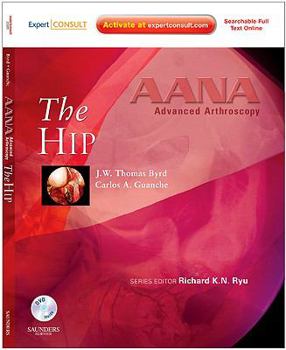 Hardcover AANA Advanced Arthroscopy: The Hip: Expert Consult: Online, Print and DVD Book
