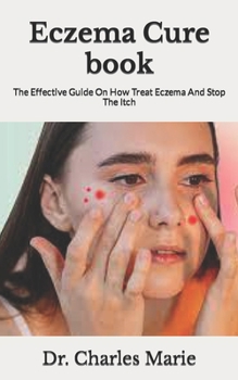 Paperback Eczema Cure book: The Effective Guide On How Treat Eczema And Stop The Itch Book