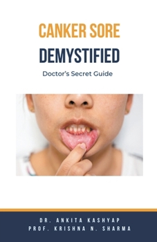 Paperback Canker Sore Demystified: Doctor's Secret Guide Book