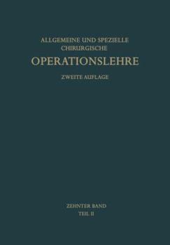 Paperback Die Operationen an Den Extremitäten: Die Operationen an Der Unteren Extremität [German] Book