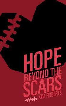 Paperback Hope Beyond the Scars Book