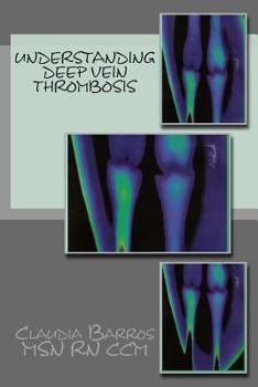 Paperback Understanding Deep Vein Thrombosis Book