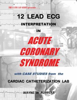 12 Lead ECG Interpretation in Acute Coronary Syndrome with Case Studies from the Cardiac Catheterization Lab