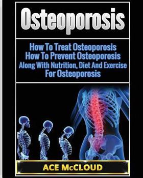 Paperback Osteoporosis: How To Treat Osteoporosis: How To Prevent Osteoporosis: Along With Nutrition, Diet And Exercise For Osteoporosis [Large Print] Book