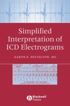 Paperback Simplified Interpretation of ICD Electrograms Book