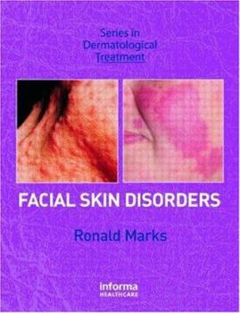 Facial Skin Disorders (Series in Dermatological Treatment)