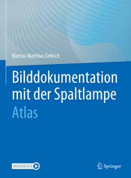 Hardcover Bilddokumentation Mit Der Spaltlampe: Atlas [German] Book