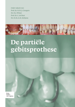 Hardcover de Partiële Gebitsprothese: Uitgangspunten Bij de Diagnostiek En Behandeling Van Het Gemutileerde Gebit [Dutch] Book