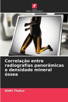 Paperback Correlação entre radiografias panorâmicas e densidade mineral óssea [Portuguese] Book