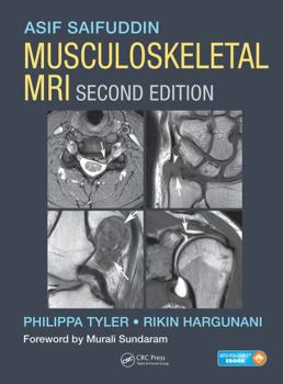 Hardcover Musculoskeletal MRI Book