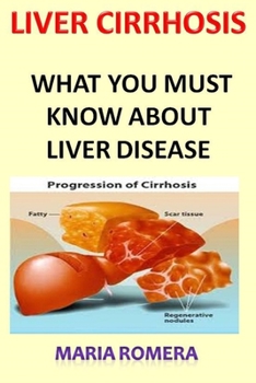 Paperback Liver Cirrhosis: What You Must Know About Liver Disease Book