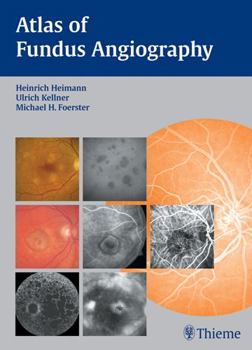 Hardcover Atlas of Fundus Angiography Book