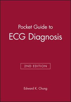 Paperback Pocket Guide to ECG Diagnosis Book