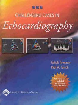 Hardcover Challenging Cases in Echocardiography Book