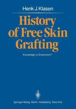 Paperback History of Free Skin Grafting: Knowledge or Empiricism? Book