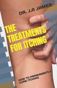 Paperback The Treatments for Itching: How to Permanently Cure Itching Book