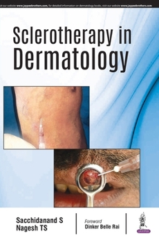 Paperback Sclerotherapy In Dermatology Book