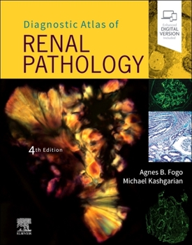 Hardcover Diagnostic Atlas of Renal Pathology Book