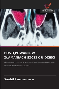Paperback PostEpowanie W Zlamaniach SzczEk U Dzieci (Polish Edition) [Polish] Book