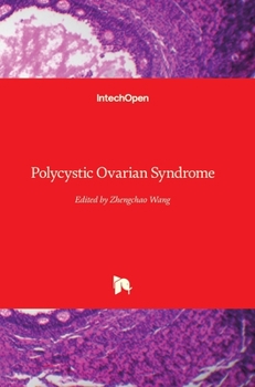 Hardcover Polycystic Ovarian Syndrome Book